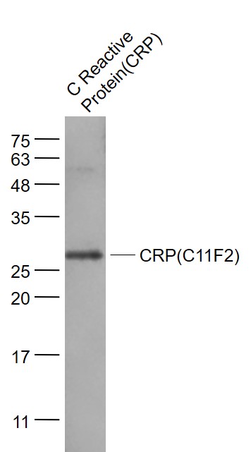 Lane 1: C Reactive Protein(CRP) probed with CRP(C11F2) Monoclona Antibody, Unconjugated (bsm-0391M) at 1:1000 dilution and 4˚C overnight incubation. Followed by conjugated secondary antibody incubation at 1:20000 for 60 min at 37˚C.