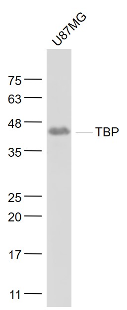 Lane 1: U87MG cell lysates probed with TBP Monoclonal Antibody, Unconjugated (bsm-33227M) at 1:1000 dilution and 4˚C overnight incubation. Followed by conjugated secondary antibody incubation at 1:20000 for 60 min at 37˚C.