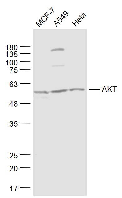 Lane 1: MCF-7 cell lysates; Lane 2: A549 cell lysates; Lane 3: Hela cell lysates probed with AKT Monoclonal Antibody, Unconjugated (bsm-33278M) at 1:1000 dilution and 4˚C overnight incubation. Followed by conjugated secondary antibody incubation at 1:20000 for 60 min at 37˚C.