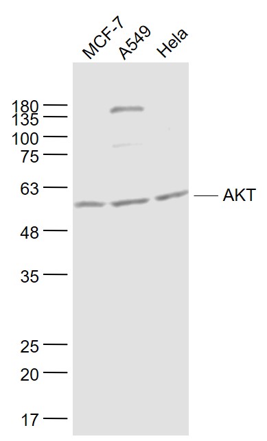 Lane 1: MCF-7 cell lysates; Lane 2: A549 cell lysates; Lane 3: Hela cell lysates probed with AKT Monoclonal Antibody, Unconjugated (bsm-33282M) at 1:1000 dilution and 4˚C overnight incubation. Followed by conjugated secondary antibody incubation at 1:20000 for 60 min at 37˚C.