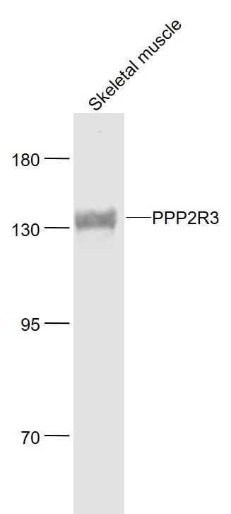 Lane 1: Mouse Skeletal muscle lysates probed with PPP2R3 Polyclonal Antibody, Unconjugated (bs-5759R) at 1:1000 dilution and 4˚C overnight incubation. Followed by conjugated secondary antibody incubation at 1:20000 for 60 min at 37˚C.