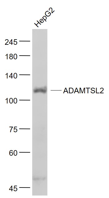 Lane 1: HepG2 cell lysates probed with ADAMTSL2 Polyclonal Antibody, Unconjugated (bs-5862R) at 1:1000 dilution and 4˚C overnight incubation. Followed by conjugated secondary antibody incubation at 1:20000 for 60 min at 37˚C.