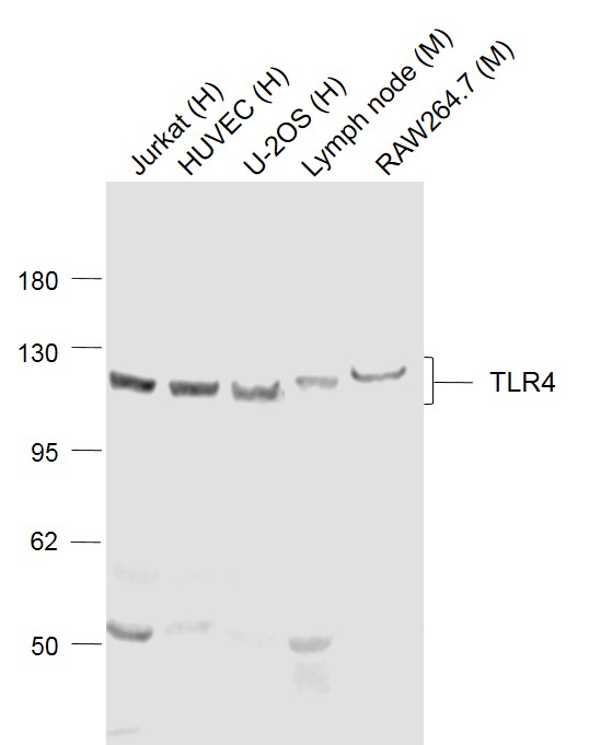 Lane 1: Jurkat cell lysates; Lane 2: HUVEC cell lysates; Lane 3: U-2OS cell lysates; Lane 4: Mouse Lymph node lysates ; Lane 5: Mouse Raw264.7 cell lysates probed with TLR4 Polyclonal Antibody, Unconjugated (bs-20594R) at 1:1000 dilution and 4˚C overnight incubation. Followed by conjugated secondary antibody incubation at 1:20000 for 60 min at 37˚C.