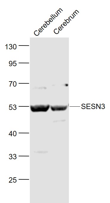 Lane 1: Mouse Cerebellum lysates; Lane 2: Mouse Cerebrum lysates probed with SESN3 Polyclonal Antibody, Unconjugated (bs-6100R) at 1:1000 dilution and 4˚C overnight incubation. Followed by conjugated secondary antibody incubation at 1:20000 for 60 min at 37˚C.