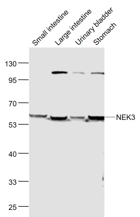 Lane 1: Mouse Small intestine lysates; Lane 2: Mouse Large intestine lysates; Lane 3: Mouse Urinary bladder lysates; Lane 4: Mouse Stomach lysates probed with NEK3 Polyclonal Antibody, Unconjugated (bs-6261R) at 1:1000 dilution and 4˚C overnight incubation. Followed by conjugated secondary antibody incubation at 1:20000 for 60 min at 37˚C.