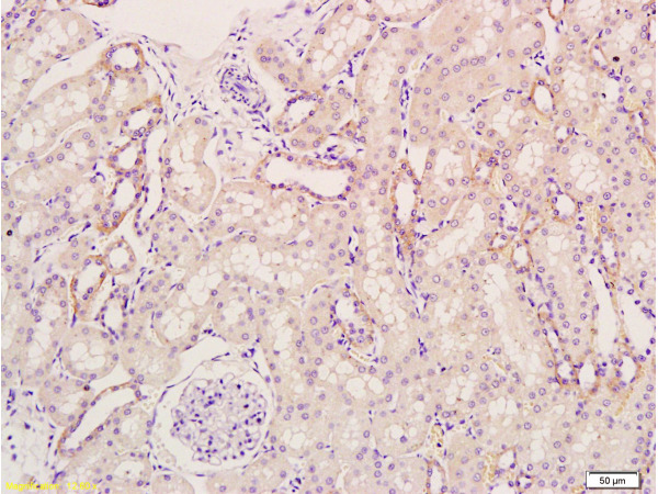 Formalin-fixed and paraffin embedded rat kidney tissue labeled Anti-KGF/FGF7 Polyclonal Antibody, Unconjugated (bs-0734R) at 1:300, followed by conjugation to the secondary antibody and DAB staining
