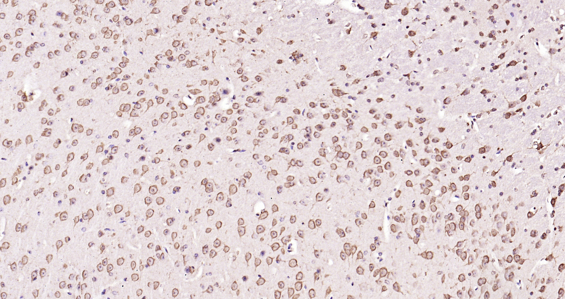 Paraformaldehyde-fixed, paraffin embedded Mouse brain; Antigen retrieval by boiling in sodium citrate buffer (pH6.0) for 15min; Block endogenous peroxidase by 3% hydrogen peroxide for 20 minutes; Blocking buffer (normal goat serum) at 37°C for 30min; Antibody incubation with ERK1(T202/Y204)+ERK2(T183/Y185) Polyclonal Antibody, Unconjugated (bs-1646R) at 1:200 overnight at 4°C, DAB staining.