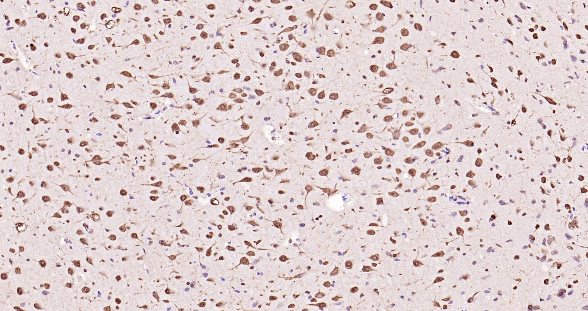 Paraformaldehyde-fixed, paraffin embedded Rat brain; Antigen retrieval by boiling in sodium citrate buffer (pH6.0) for 15min; Block endogenous peroxidase by 3% hydrogen peroxide for 20 minutes; Blocking buffer (normal goat serum) at 37°C for 30min; Antibody incubation with ERK1(T202/Y204)+ERK2(T183/Y185) Polyclonal Antibody, Unconjugated (bs-1646R) at 1:200 overnight at 4°C, DAB staining.