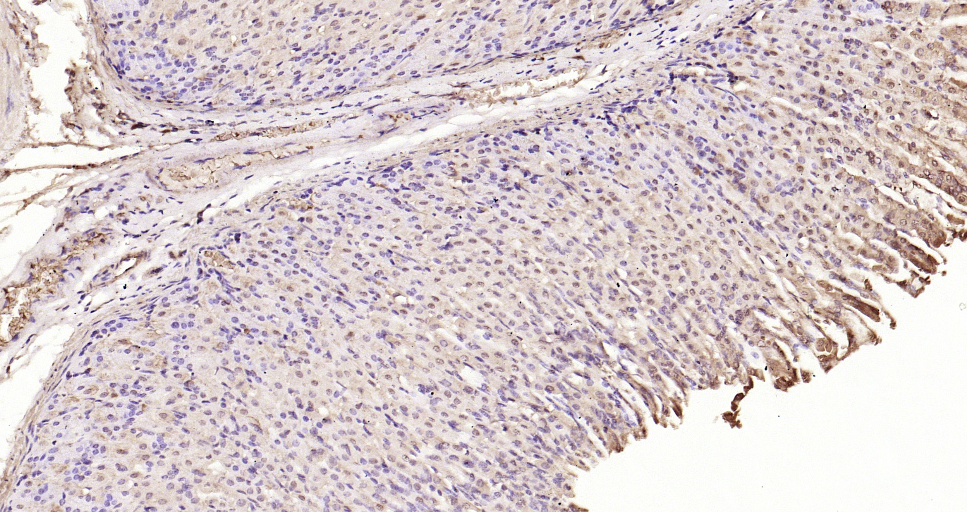 Paraformaldehyde-fixed, paraffin embedded Mouse stomach; Antigen retrieval by boiling in sodium citrate buffer (pH6.0) for 15min; Block endogenous peroxidase by 3% hydrogen peroxide for 20 minutes; Blocking buffer (normal goat serum) at 37°C for 30min; Antibody incubation with SQSTM1 Polyclonal Antibody, Unconjugated (bs-2951R) at 1:200 overnight at 4°C, DAB staining.