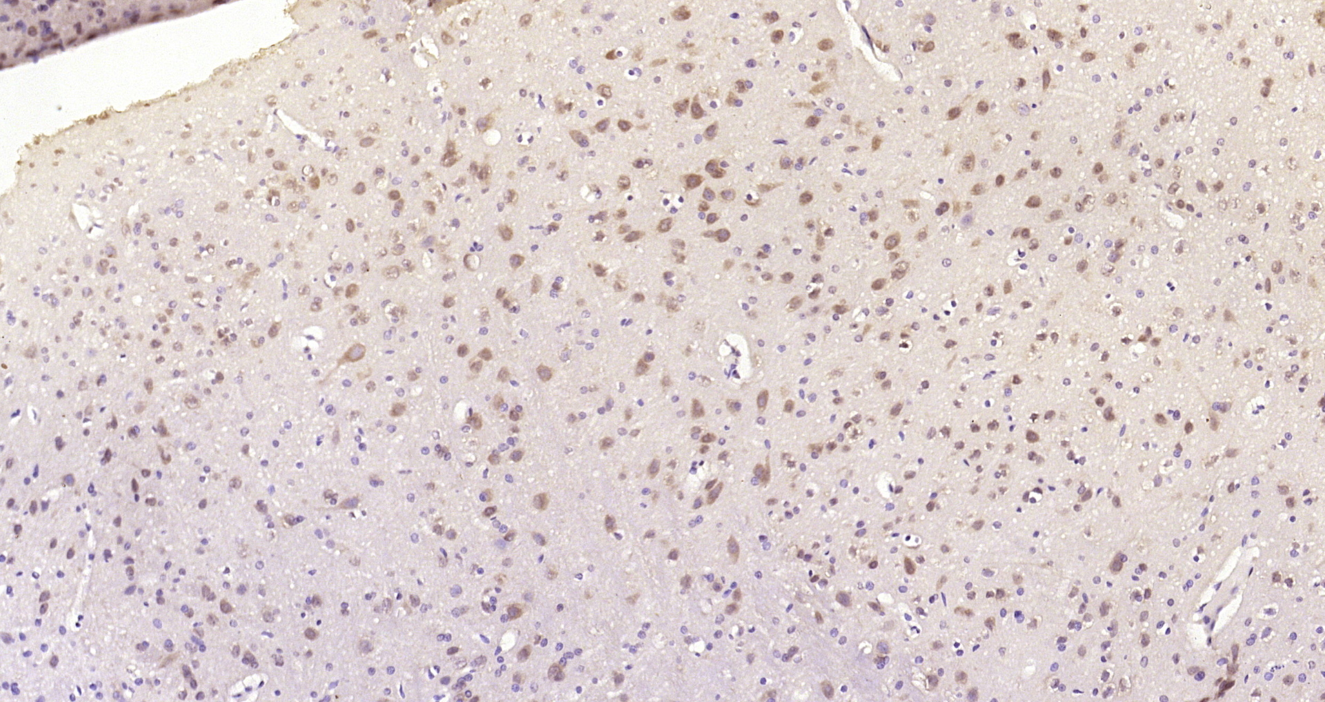 Paraformaldehyde-fixed, paraffin embedded Rat brain; Antigen retrieval by boiling in sodium citrate buffer (pH6.0) for 15min; Block endogenous peroxidase by 3% hydrogen peroxide for 20 minutes; Blocking buffer (normal goat serum) at 37°C for 30min; Antibody incubation with ERK1/2(Thr202 + Tyr204) Polyclonal Antibody, Unconjugated (bs-3016R) at 1:200 overnight at 4°C, DAB staining.