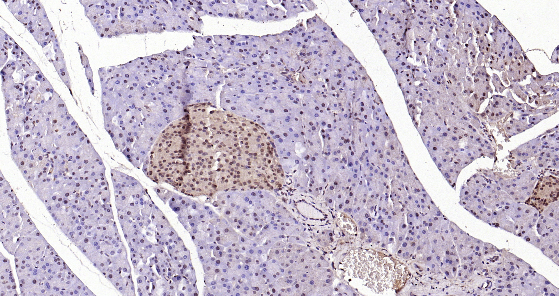 Paraformaldehyde-fixed, paraffin embedded Mouse pancreas; Antigen retrieval by boiling in sodium citrate buffer (pH6.0) for 15min; Block endogenous peroxidase by 3% hydrogen peroxide for 20 minutes; Blocking buffer (normal goat serum) at 37°C for 30min; Antibody incubation with ERK1/2(Thr202 + Tyr204) Polyclonal Antibody, Unconjugated (bs-3016R) at 1:200 overnight at 4°C, DAB staining.