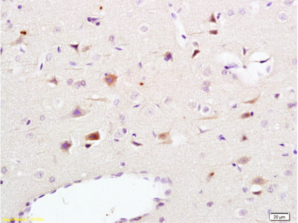 Formalin-fixed and paraffin embedded rat brain tissue labeled Anti-NCAM1 Polyclonal Antibody, Unconjugated (bs-0736R) at 1:200, followed by conjugation to the secondary antibody and DAB staining