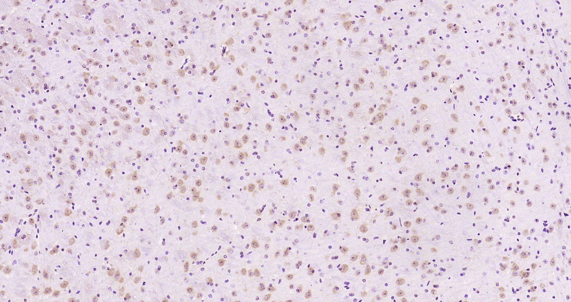 Paraformaldehyde-fixed, paraffin embedded Mouse brain; Antigen retrieval by boiling in sodium citrate buffer (pH6.0) for 15min; Block endogenous peroxidase by 3% hydrogen peroxide for 20 minutes; Blocking buffer (normal goat serum) at 37°C for 30min; Antibody incubation with ERK1/2(Thr202 + Tyr204) Polyclonal Antibody, Unconjugated (bs-3016R) at 1:200 overnight at 4°C, DAB staining.