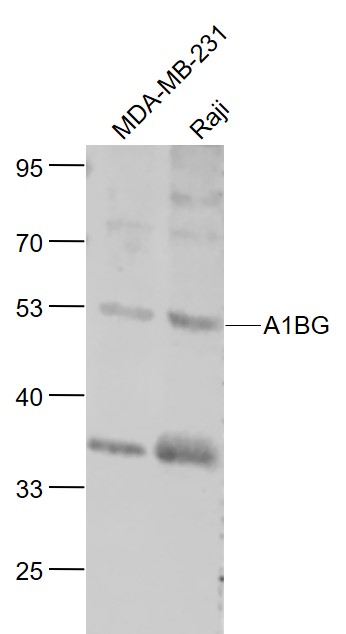 Lane 1: MBA-MB-231 cell lysates; Lane 2: Raji cell lysates probed with A1BG Polyclonal Antibody, Unconjugated (bs-6772R) at 1:1000 dilution and 4˚C overnight incubation. Followed by conjugated secondary antibody incubation at 1:20000 for 60 min at 37˚C.