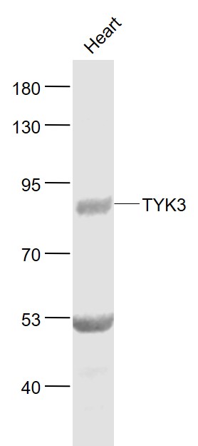 Lane 1: Mouse Heart lysates probed with TYK3 Polyclonal Antibody, Unconjugated (bs-6914R) at 1:1000 dilution and 4˚C overnight incubation. Followed by conjugated secondary antibody incubation at 1:20000 for 60 min at 37˚C.