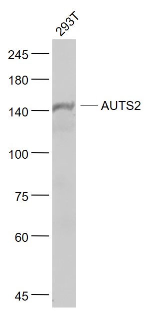 Lane 1: 293T cell lysates probed with AUTS2 Polyclonal Antibody, Unconjugated (bs-6915R) at 1:1000 dilution and 4˚C overnight incubation. Followed by conjugated secondary antibody incubation at 1:20000 for 60 min at 37˚C.