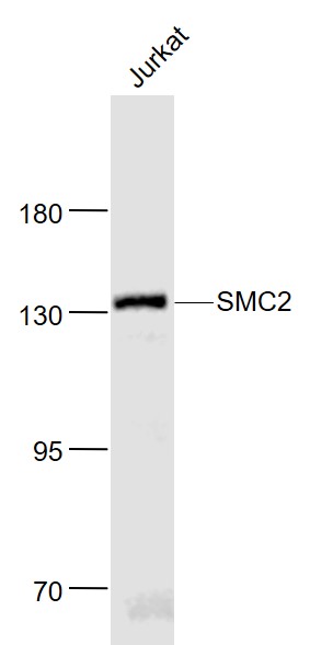Lane 1: Jurkat cell lysates probed with SMC2 Polyclonal Antibody, Unconjugated (bs-7727R) at 1:1000 dilution and 4˚C overnight incubation. Followed by conjugated secondary antibody incubation at 1:20000 for 60 min at 37˚C.