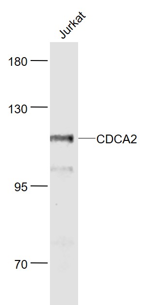 Lane 1: Jurkat cell lysates probed with CDCA2 Polyclonal Antibody, Unconjugated (bs-7786R) at 1:1000 dilution and 4˚C overnight incubation. Followed by conjugated secondary antibody incubation at 1:20000 for 60 min at 37˚C.