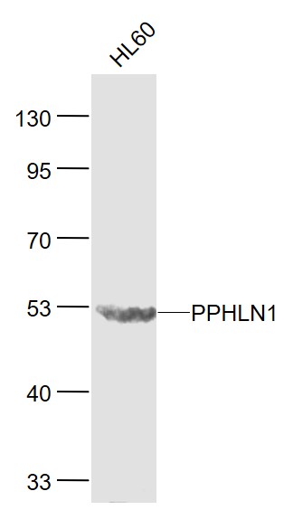 Lane 1: HL60 cell lysates probed with PPHLN1 Polyclonal Antibody, Unconjugated (bs-7872R) at 1:1000 dilution and 4˚C overnight incubation. Followed by conjugated secondary antibody incubation at 1:20000 for 60 min at 37˚C. Lane 1: HL60 cell lysates probed with PPHLN1 Polyclonal Antibody, Unconjugated (bs-7872R) at 1:1000 dilution and 4˚C overnight incubation. Followed by conjugated secondary antibody incubation at 1:20000 for 60 min at 37˚C.