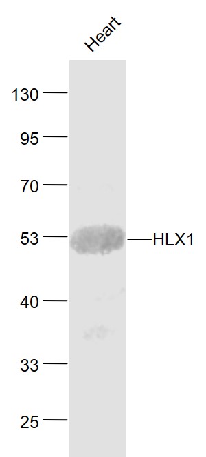 Lane 1: Mouse Heart lysates probed with HLX1 Polyclonal Antibody, Unconjugated (bs-8174R) at 1:1000 dilution and 4˚C overnight incubation. Followed by conjugated secondary antibody incubation at 1:20000 for 60 min at 37˚C.