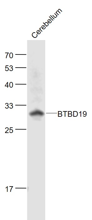 Lane 1: Mouse Cerebellum lysates probed with BTBD19 Polyclonal Antibody, Unconjugated (bs-8401R) at 1:1000 dilution and 4˚C overnight incubation. Followed by conjugated secondary antibody incubation at 1:20000 for 60 min at 37˚C.