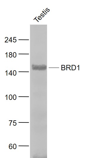 Lane 1: Mouse Testis lysates probed with BRD1 Polyclonal Antibody, Unconjugated (bs-8426R) at 1:1000 dilution and 4˚C overnight incubation. Followed by conjugated secondary antibody incubation at 1:20000 for 60 min at 37˚C.