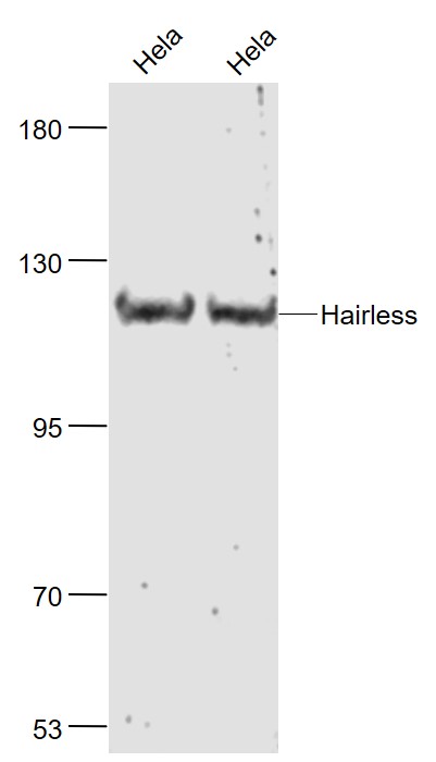 Lane 1: Hela cell lysates; Lane 2: Hela cell lysates probed with Hairless Polyclonal Antibody, Unconjugated (bs-8507R) at 1:1000 dilution and 4˚C overnight incubation. Followed by conjugated secondary antibody incubation at 1:20000 for 60 min at 37˚C.