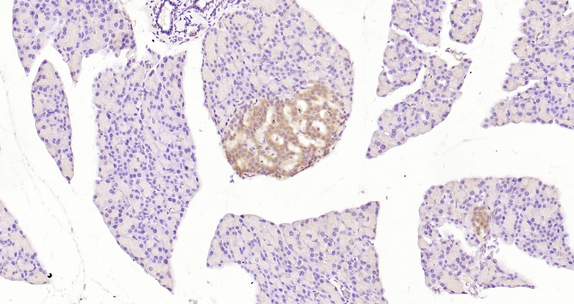 Paraformaldehyde-fixed, paraffin embedded Rat pancreas; Antigen retrieval by boiling in sodium citrate buffer (pH6.0) for 15min; Block endogenous peroxidase by 3% hydrogen peroxide for 20 minutes; Blocking buffer (normal goat serum) at 37°C for 30min; Antibody incubation with PERK(Thr980) Polyclonal Antibody, Unconjugated (bs-3330R) at 1:200 overnight at 4°C, DAB staining.