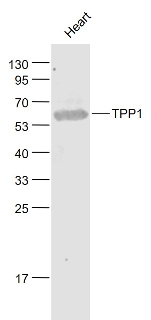 Lane 1: Mouse Heart lysates probed with TPP1 Polyclonal Antibody, Unconjugated (bs-8528R) at 1:1000 dilution and 4˚C overnight incubation. Followed by conjugated secondary antibody incubation at 1:20000 for 60 min at 37˚C.