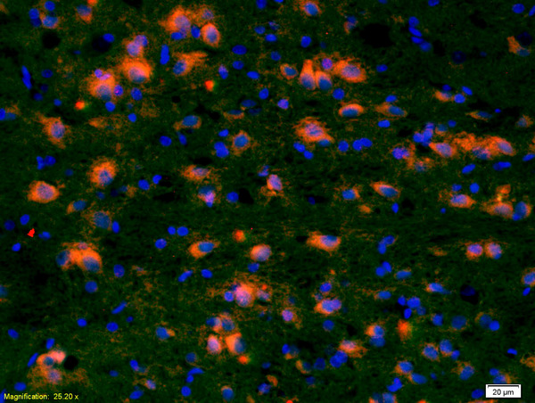 Formalin-fixed and paraffin-embedded rat brain labeled with Anti-CCDC12 Polyclonal Antibody, Unconjugated(bs-8104R) 1:200, overnight at 4°C, The secondary antibody was Goat Anti-Rabbit IgG, Cy3 conjugated(bs-0295G-Cy3)used at 1:200 dilution for 40 minutes at 37°C. Formalin-fixed and paraffin-embedded rat brain labeled with Anti-CCDC12 Polyclonal Antibody, Unconjugated(bs-8104R) 1:200, overnight at 4°C, The secondary antibody was Goat Anti-Rabbit IgG, Cy3 conjugated(bs-0295G-Cy3)used at 1:200 dilution for 40 minutes at 37°C.