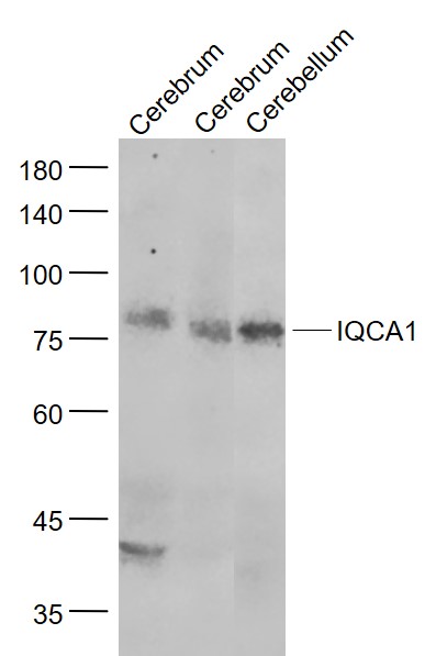 Lane 1: Mouse Cerebrum lysates; Lane 2: Rat Cerebrum lysates; Lane 3: Mouse Cerebellum lysates probed with IQCA1 Polyclonal Antibody, Unconjugated (bs-9020R) at 1:1000 dilution and 4˚C overnight incubation. Followed by conjugated secondary antibody incubation at 1:20000 for 60 min at 37˚C.