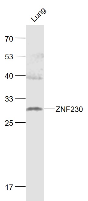 Lane 1: Mouse Lung lysates probed with ZNF230 Polyclonal Antibody, Unconjugated (bs-9143R) at 1:1000 dilution and 4˚C overnight incubation. Followed by conjugated secondary antibody incubation at 1:20000 for 60 min at 37˚C.