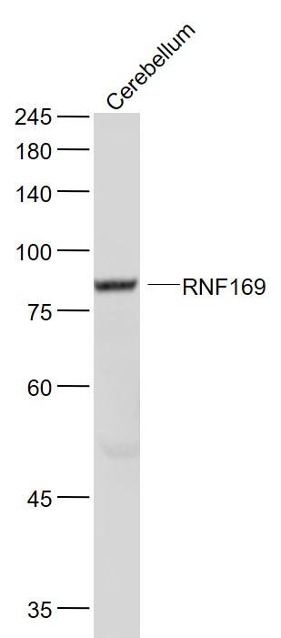 Lane 1: Mouse Cerebellum lysates probed with RNF169 Polyclonal Antibody, Unconjugated (bs-9259R) at 1:1000 dilution and 4˚C overnight incubation. Followed by conjugated secondary antibody incubation at 1:20000 for 60 min at 37˚C.