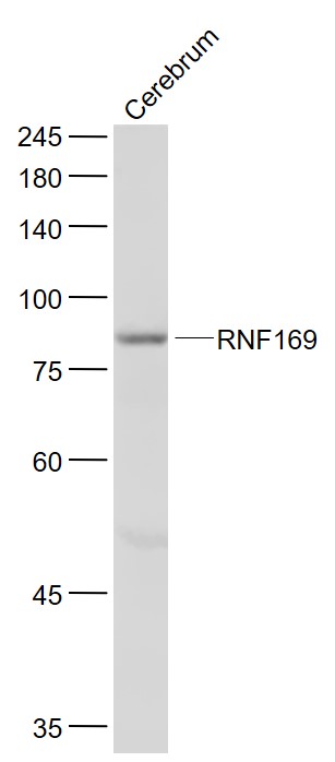 Lane 1: Mouse Cerebrum lysates probed with RNF169 Polyclonal Antibody, Unconjugated (bs-9259R) at 1:1000 dilution and 4˚C overnight incubation. Followed by conjugated secondary antibody incubation at 1:20000 for 60 min at 37˚C.