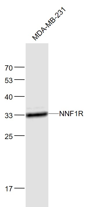 Lane 1: MDA-MB-231 cell lysates probed with NNF1R Polyclonal Antibody, Unconjugated (bs-9319R) at 1:1000 dilution and 4˚C overnight incubation. Followed by conjugated secondary antibody incubation at 1:20000 for 60 min at 37˚C.