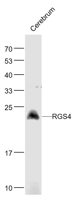 Lane 1: Rat Cerebrum lysates probed with RGS4 Polyclonal Antibody, Unconjugated (bs-9452R) at 1:1000 dilution and 4˚C overnight incubation. Followed by conjugated secondary antibody incubation at 1:20000 for 60 min at 37˚C. Lane 1: Rat Cerebrum lysates probed with RGS4 Polyclonal Antibody, Unconjugated (bs-9452R) at 1:1000 dilution and 4˚C overnight incubation. Followed by conjugated secondary antibody incubation at 1:20000 for 60 min at 37˚C.