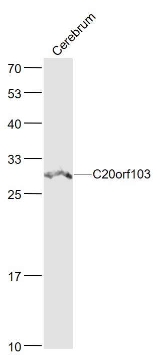 Lane 1: Mouse Cerebrum lysates probed with C20orf103 Polyclonal Antibody, Unconjugated (bs-9691R) at 1:1000 dilution and 4˚C overnight incubation. Followed by conjugated secondary antibody incubation at 1:20000 for 60 min at 37˚C.