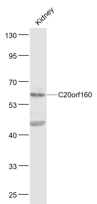 Lane 1: Mouse Kidney lysates probed with C20orf160 Polyclonal Antibody, Unconjugated (bs-9695R) at 1:1000 dilution and 4˚C overnight incubation. Followed by conjugated secondary antibody incubation at 1:20000 for 60 min at 37˚C.