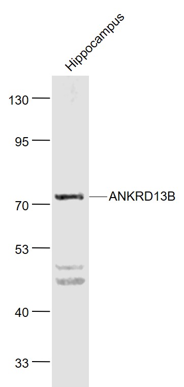 Lane 1: Mouse Hippocampus lysates probed with ANKRD13B Polyclonal Antibody, Unconjugated (bs-9745R) at 1:1000 dilution and 4˚C overnight incubation. Followed by conjugated secondary antibody incubation at 1:20000 for 60 min at 37˚C.