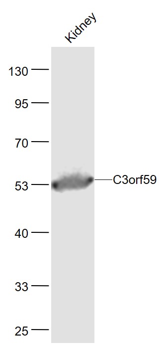 Lane 1: Mouse Kidney lysates probed with C3orf59 Polyclonal Antibody, Unconjugated (bs-9833R) at 1:1000 dilution and 4˚C overnight incubation. Followed by conjugated secondary antibody incubation at 1:20000 for 60 min at 37˚C. Lane 1: Mouse Kidney lysates probed with C3orf59 Polyclonal Antibody, Unconjugated (bs-9833R) at 1:1000 dilution and 4˚C overnight incubation. Followed by conjugated secondary antibody incubation at 1:20000 for 60 min at 37˚C.