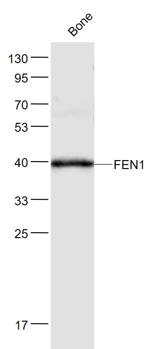 Lane 1: Mouse Bone lysates probed with FEN1 Polyclonal Antibody, Unconjugated (bs-9876R) at 1:1000 dilution and 4˚C overnight incubation. Followed by conjugated secondary antibody incubation at 1:20000 for 60 min at 37˚C.