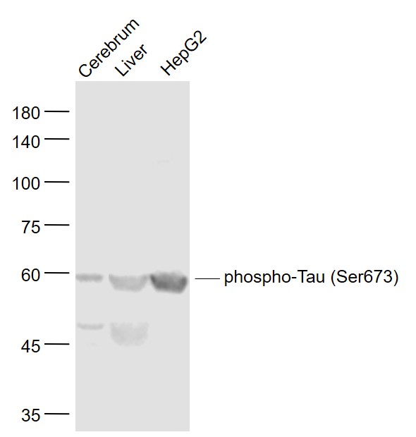 Tau protein(Ser673) Polyclonal Antibody