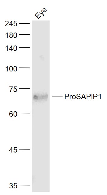 Lane 1: Mouse Eye lysates probed with ProSAPiP1 Polyclonal Antibody, Unconjugated (bs-11198R) at 1:1000 dilution and 4˚C overnight incubation. Followed by conjugated secondary antibody incubation at 1:20000 for 60 min at 37˚C.