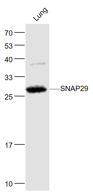 Lane 1: Mouse Lung lysates probed with SNAP29 Polyclonal Antibody, Unconjugated (bs-11363R) at 1:1000 dilution and 4˚C overnight incubation. Followed by conjugated secondary antibody incubation at 1:20000 for 60 min at 37˚C.