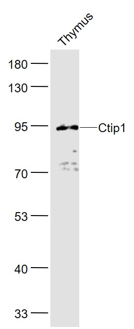 Lane 1: Mouse Thymus lysates probed with Ctip1/BCL-11A Polyclonal Antibody, Unconjugated (bs-11544R) at 1:1000 dilution and 4˚C overnight incubation. Followed by conjugated secondary antibody incubation at 1:20000 for 60 min at 37˚C.