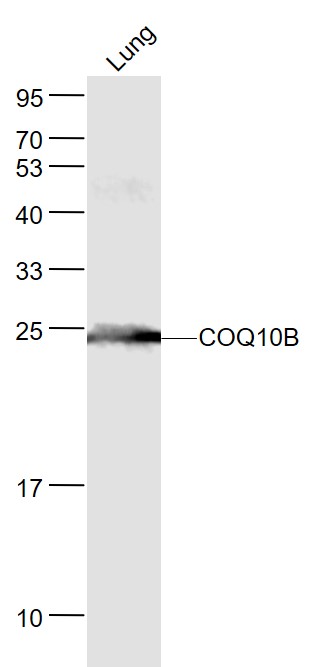 Lane 1: Mouse Lung lysates probed with COQ10B Polyclonal Antibody, Unconjugated (bs-11656R) at 1:1000 dilution and 4˚C overnight incubation. Followed by conjugated secondary antibody incubation at 1:20000 for 60 min at 37˚C.