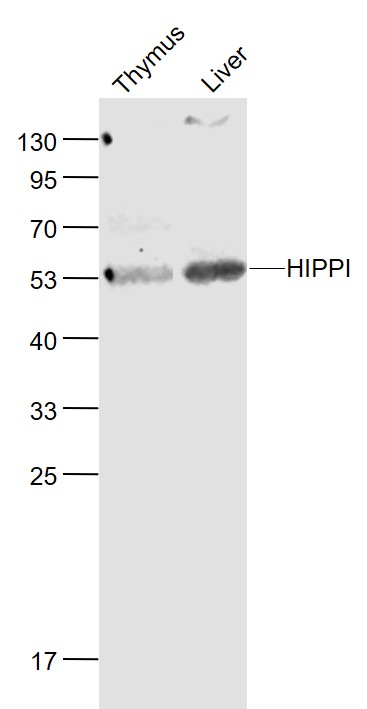 Lane 1: Mouse Thymus lysates; Lane 2: Mouse Liver lysates probed with HIPPI Polyclonal Antibody, Unconjugated (bs-11697R) at 1:1000 dilution and 4˚C overnight incubation. Followed by conjugated secondary antibody incubation at 1:20000 for 60 min at 37˚C. Lane 1: Mouse Thymus lysates; Lane 2: Mouse Liver lysates probed with HIPPI Polyclonal Antibody, Unconjugated (bs-11697R) at 1:1000 dilution and 4˚C overnight incubation. Followed by conjugated secondary antibody incubation at 1:20000 for 60 min at 37˚C.