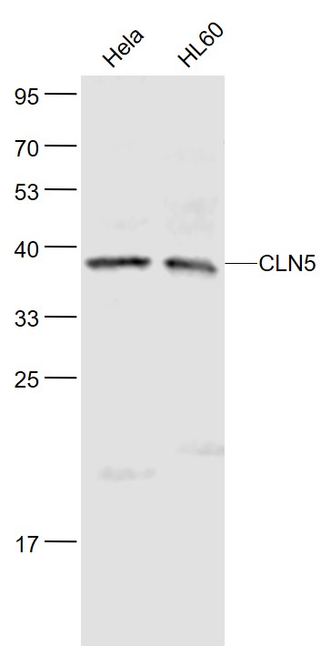 Lane 1: Hela cell lysates; Lane 2: HL60 cell lysates probed with CLN5 Polyclonal Antibody, Unconjugated (bs-11714R) at 1:1000 dilution and 4˚C overnight incubation. Followed by conjugated secondary antibody incubation at 1:20000 for 60 min at 37˚C.
