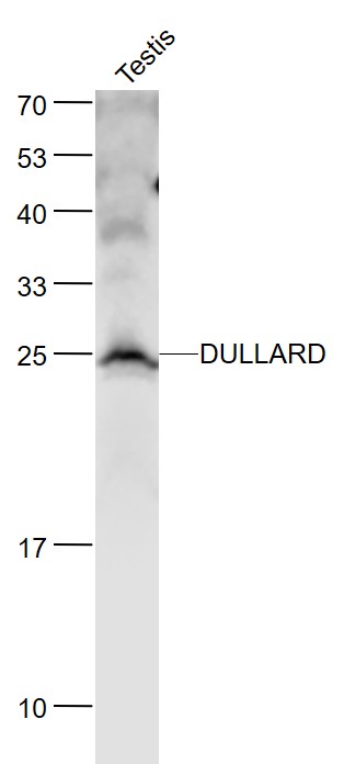 Lane 1: Mouse Testis lysates probed with DULLARD Polyclonal Antibody, Unconjugated (bs-11828R) at 1:1000 dilution and 4˚C overnight incubation. Followed by conjugated secondary antibody incubation at 1:20000 for 60 min at 37˚C.