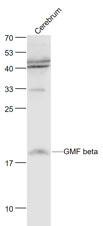 Lane 1: Mouse Cerebrum lysates probed with GMF beta Polyclonal Antibody, Unconjugated (bs-11845R) at 1:1000 dilution and 4˚C overnight incubation. Followed by conjugated secondary antibody incubation at 1:20000 for 60 min at 37˚C.